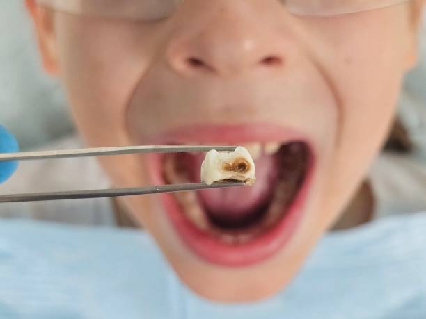 Best Broken or Cracked Tooth Emergency Dentist in Everman, TX